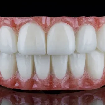 Denture3